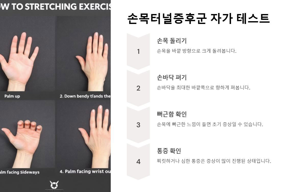 손목터널증후군 자가테스트